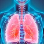 Lung cancer researchers are pioneering an inhalable screening test.